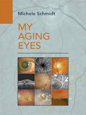 cover image of My Aging Eyes
